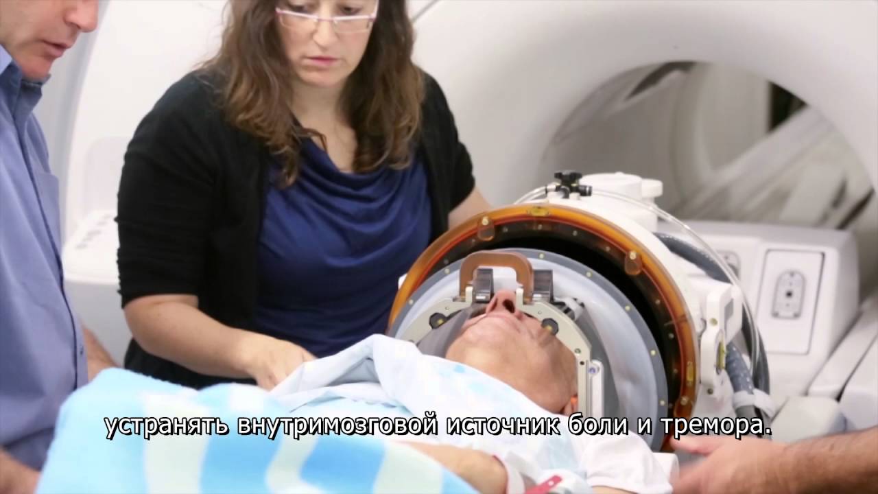 Лечение тремора (FUS-MRI) в Израиле