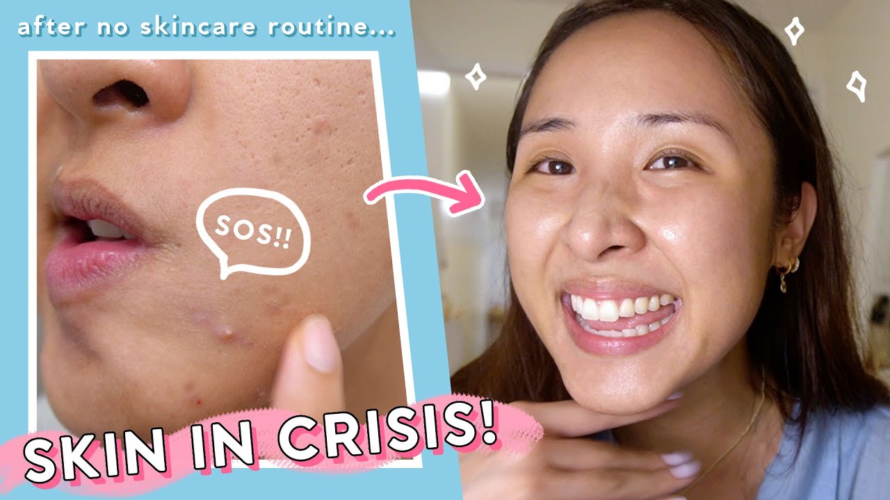 When nothing else works... 3 Easy *SOS* Steps for ALL Skin Types!
