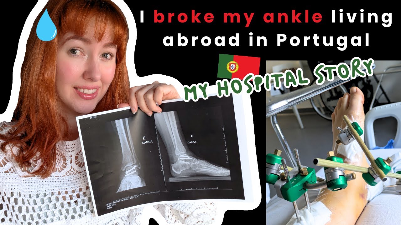 Broke & dislocated my ankle (talus bone) in Portugal - 3 Surgeries, Pain, Fear & Hope