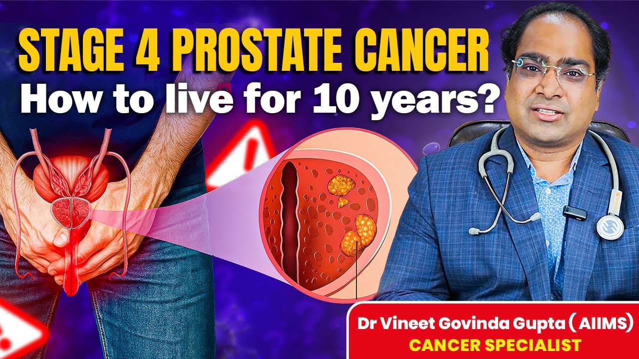 स्टेज 4 प्रोस्टेट कैंसर का आधुनिक इलाज: कैसे मरीज़ जीते हैं 10 साल से ज़्यादा - DM(AIIMS) 2025
