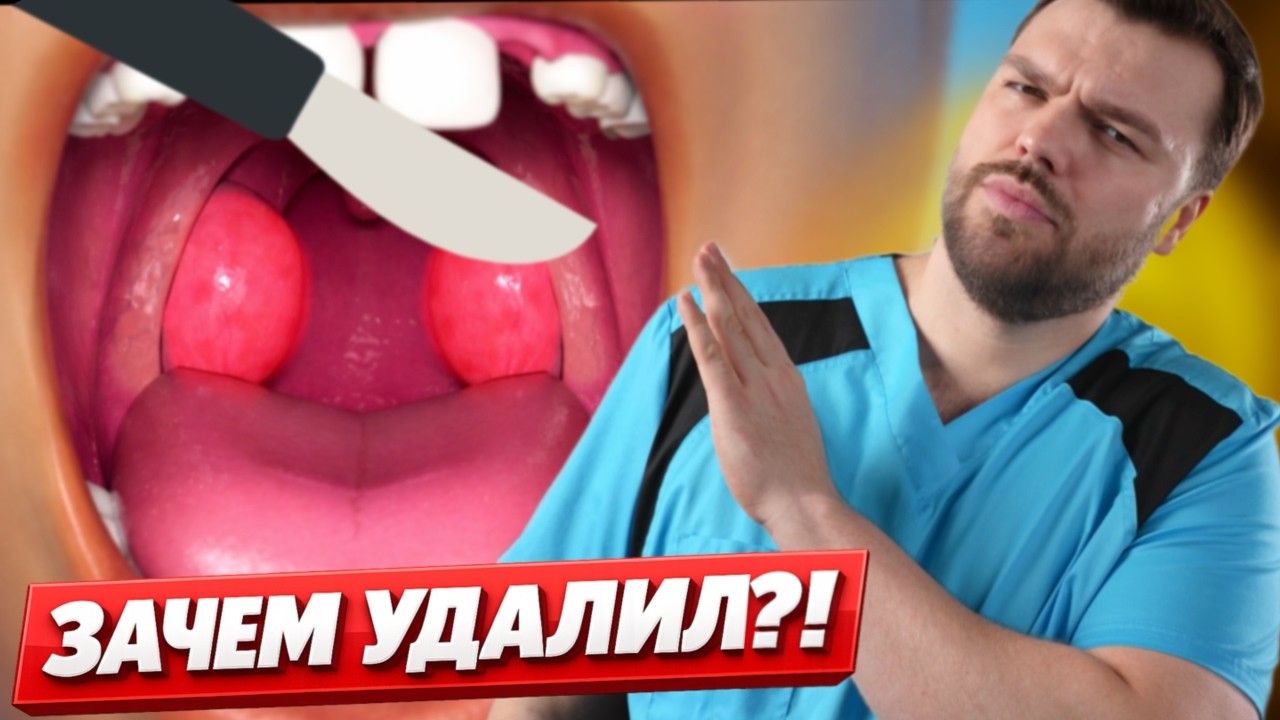 Удалять миндалины или лечить? Чёткие показания + чек-лист (ТАФ I/II, 7/5/3)