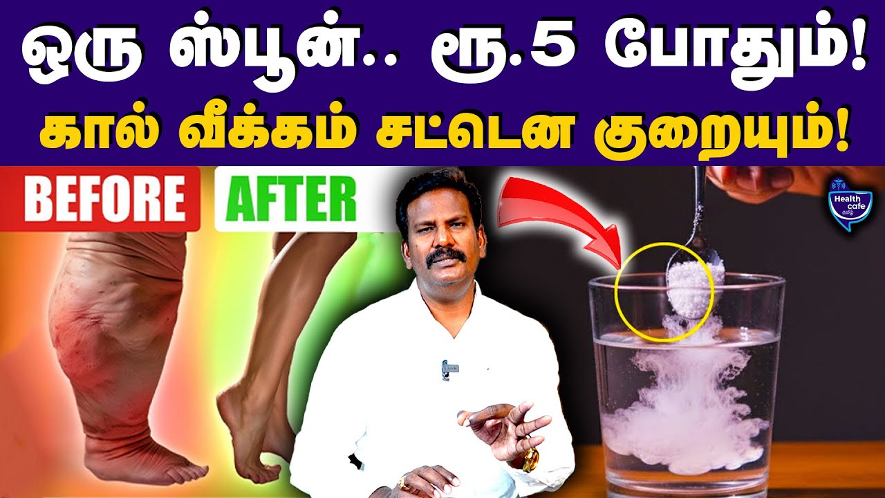 இத தண்ணில கலந்து குடிங்க.. பாத வீக்கம் சரியாகும் | Health Cafe Tamil