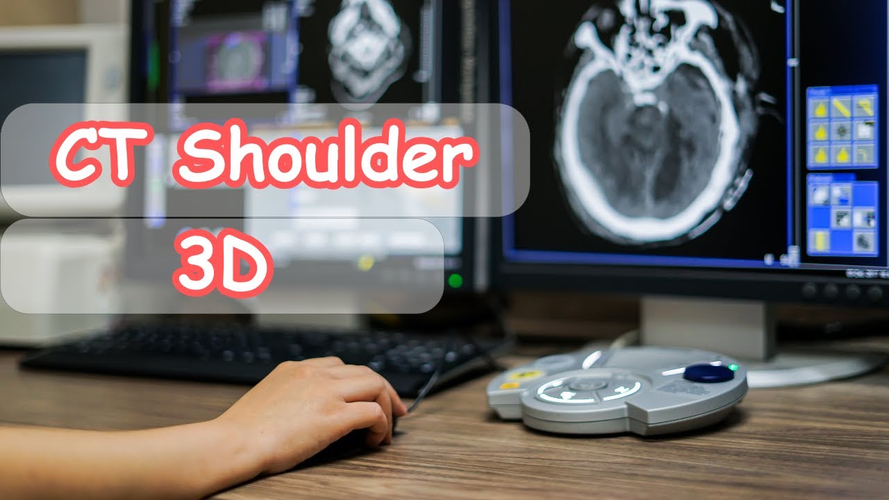 How to do ct shoulder التصوير المقطعى للكتف