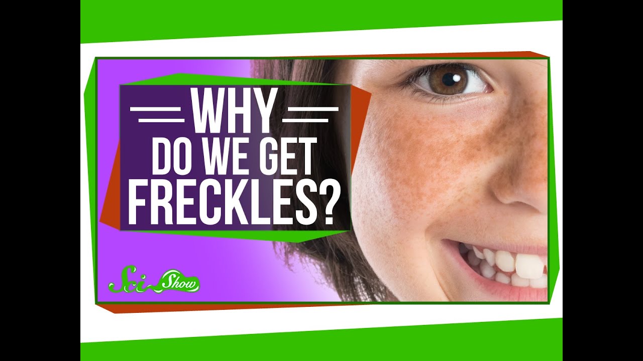 Why Do We Get Freckles?