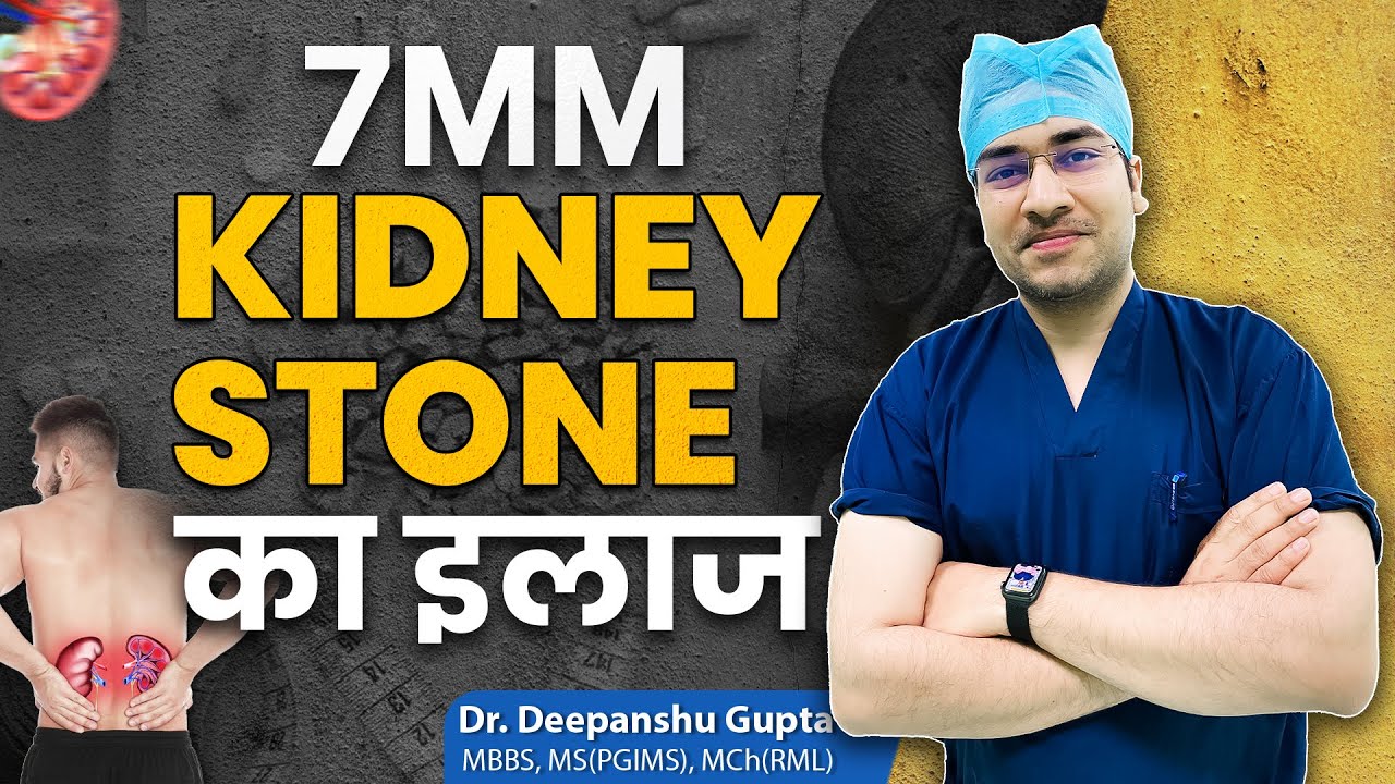 7mm Kidney Stone Kaise Nikalein? | Fast & Painless Treatment Explained