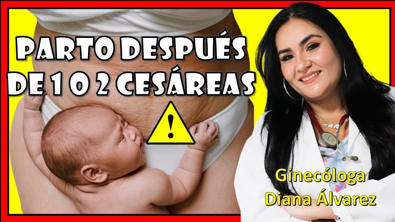 PARTO después de  1 o MAS CESAREAS ¡LO QUE DEBES SABER!  |Ginecologa Diana Alvarez