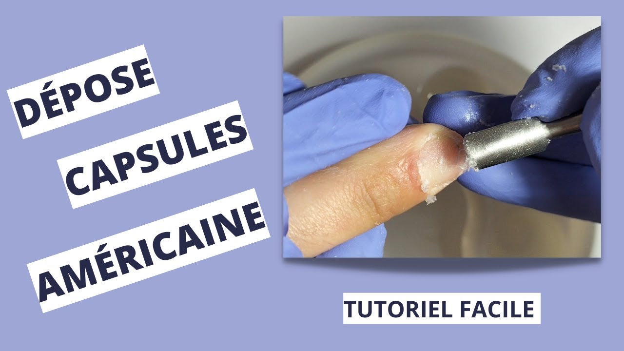Comment faire une DÉPOSE de POSE AMÉRICAINE A L'ACÉTONE
