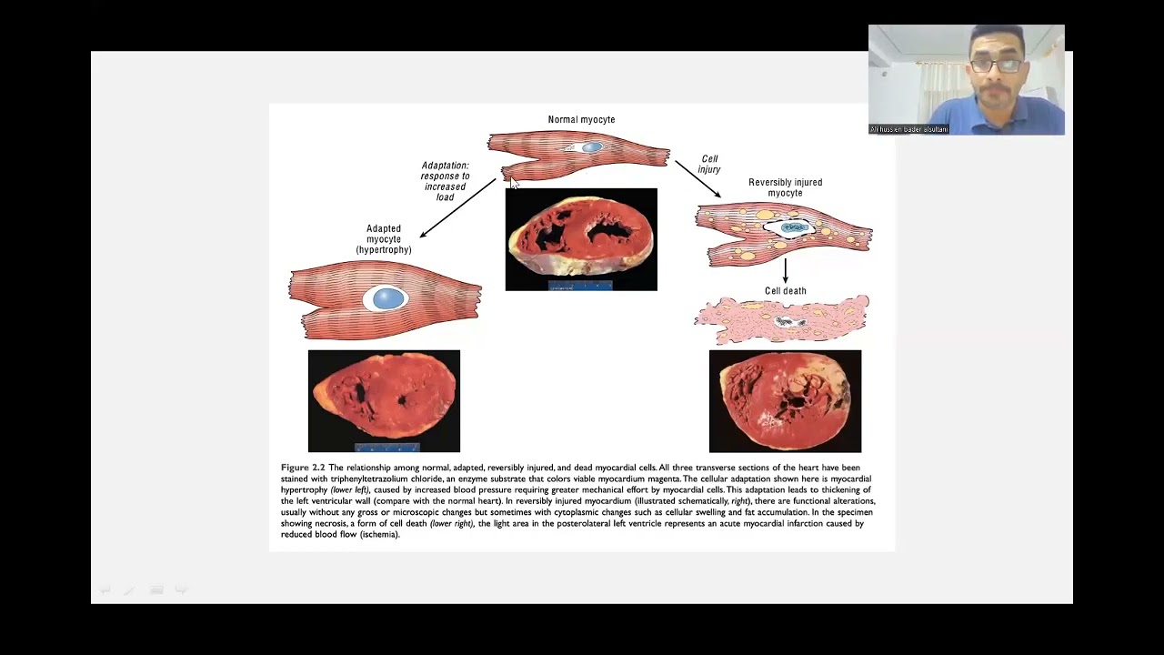 lec1 Pathology (طب المستنصرية / المرحلة الثالثة )