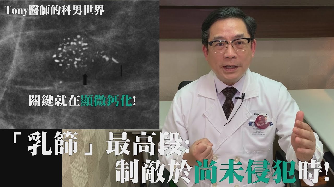 【Tony醫師的科男世界9】「乳篩」最高段: 制敵於尚未侵犯時!