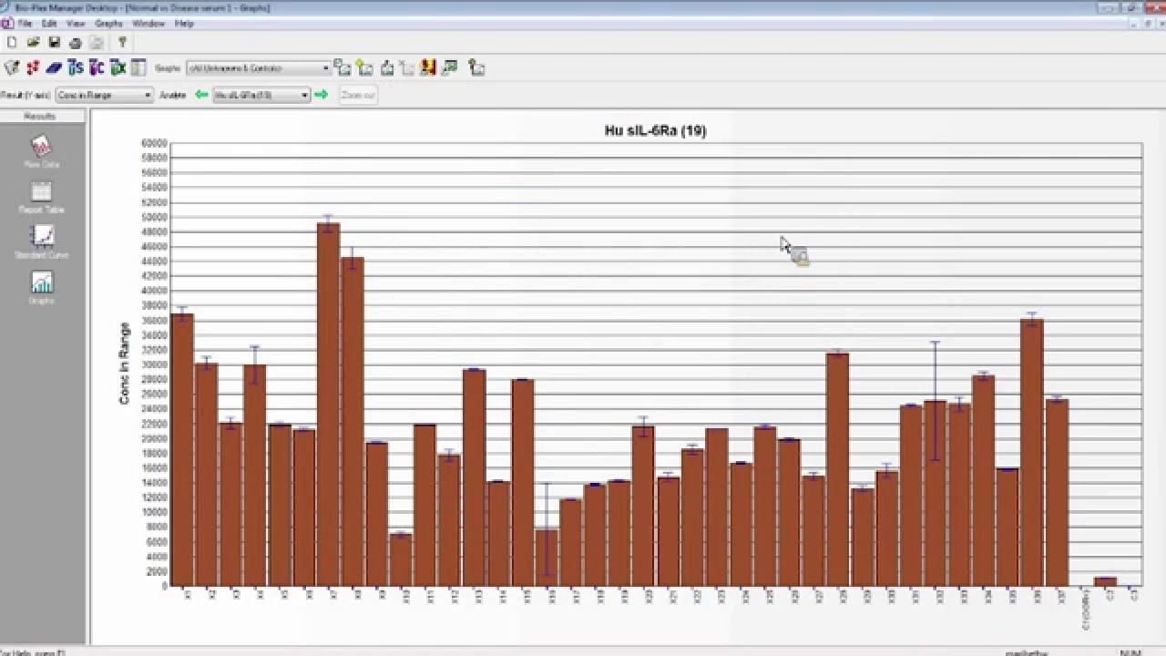 Bio-Plex Manager™ and Data Pro™ Software: Streamline Multiplex Data Analysis