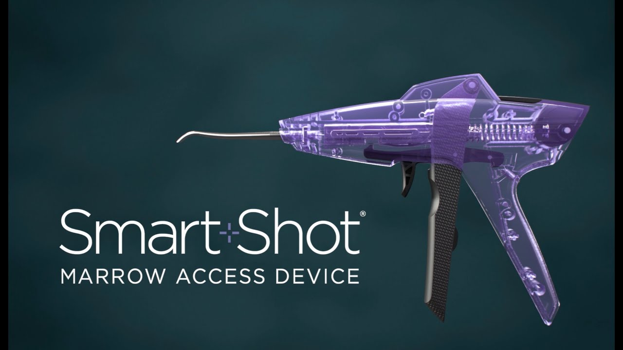 SmartShot Marrow Access - Anatomy-Preserving Cartilage Restoration