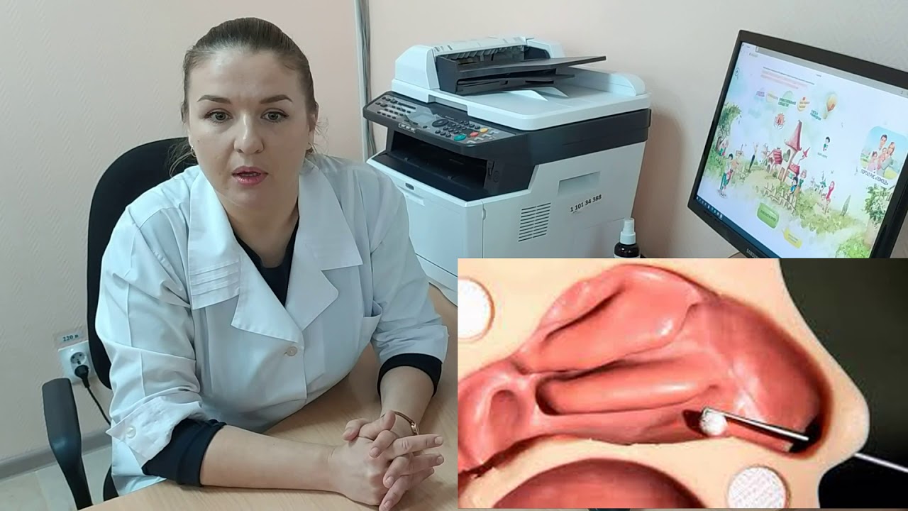 Инородные тела носа и уха у детей