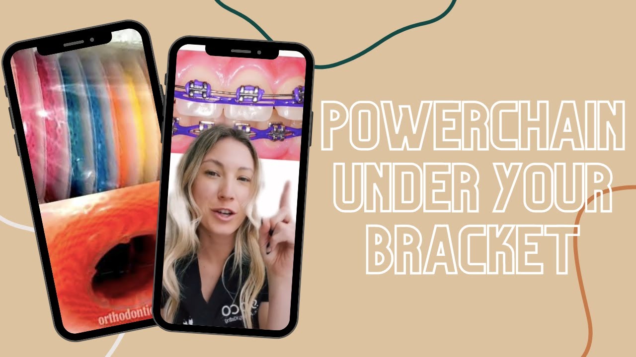 Powerchain UNDER Your Bracket #shorts
