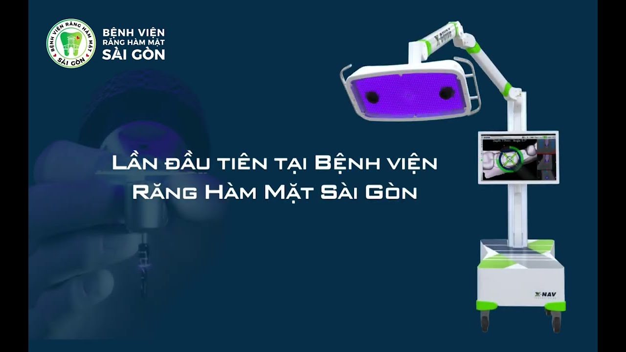 Robot định vị X-GUIDE hỗ trợ Trồng răng implant chính xác đến 0.1mm .