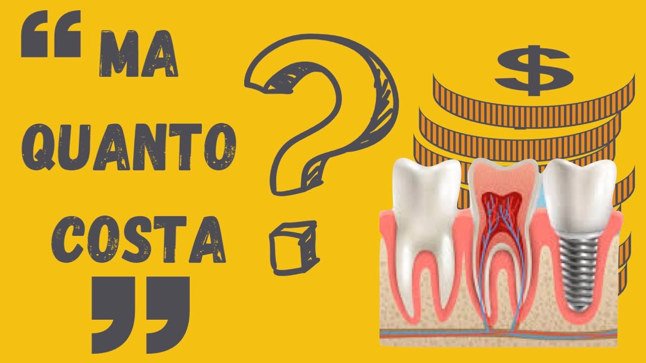 Quanto costa un impianto dentale?