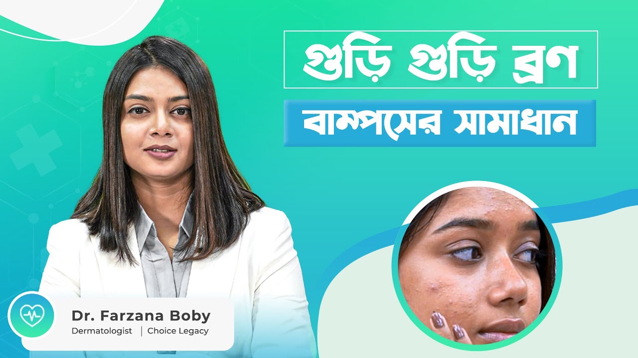 গুড়ি গুড়ি ব্রণ বা বাম্পস সমস্যার সমাধান। Dr. Farzana Boby #Dermatologist