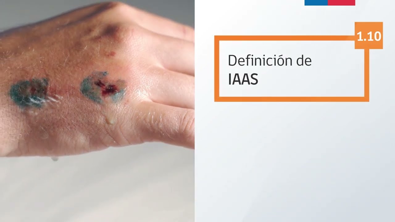 1.10 Definición de las IAAS