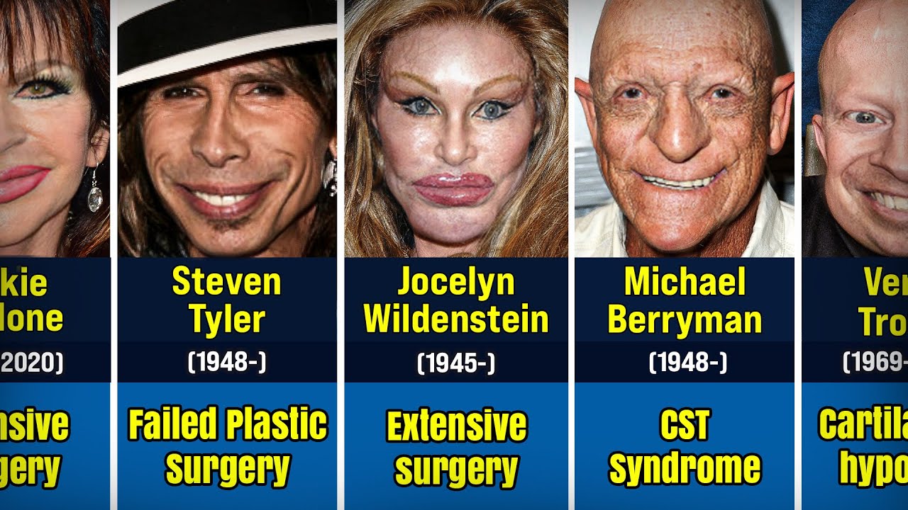 20 MOST UNATTRACTIVE Hollywood Celebrities YOU DON'T WANT TO MISS, Here are their stories’ files..