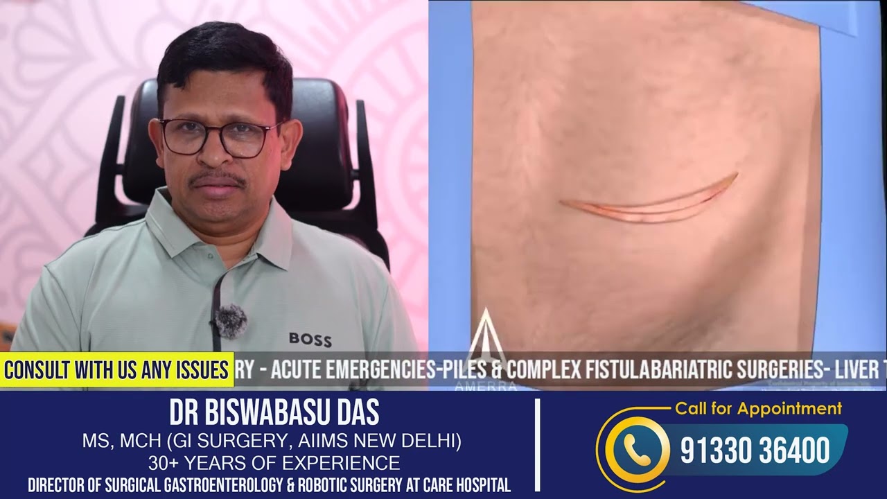 हर्निया का सबसे सुरक्षित इलाज | रोबोटिक सर्जरी बनाम लेप्रोस्कोपिक और ओपन सर्जरी | Dr. BB Das
