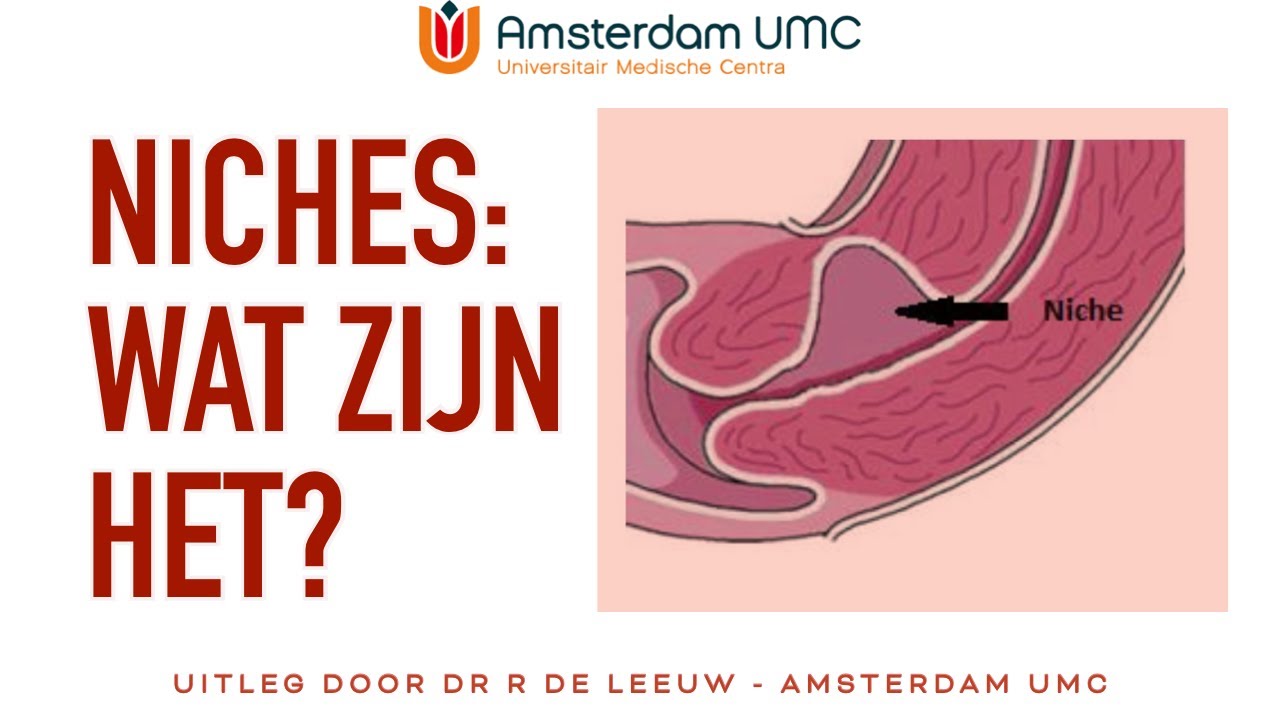[DUTCH] De niche in de baarmoeder - wat is het?