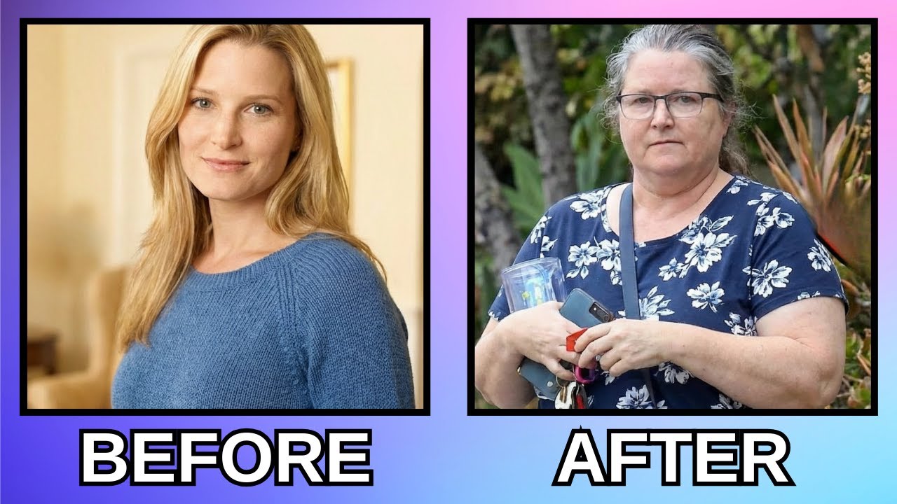 YOU’VE NEVER SEEN CELEB BEFORE & AFTER LIKE THIS