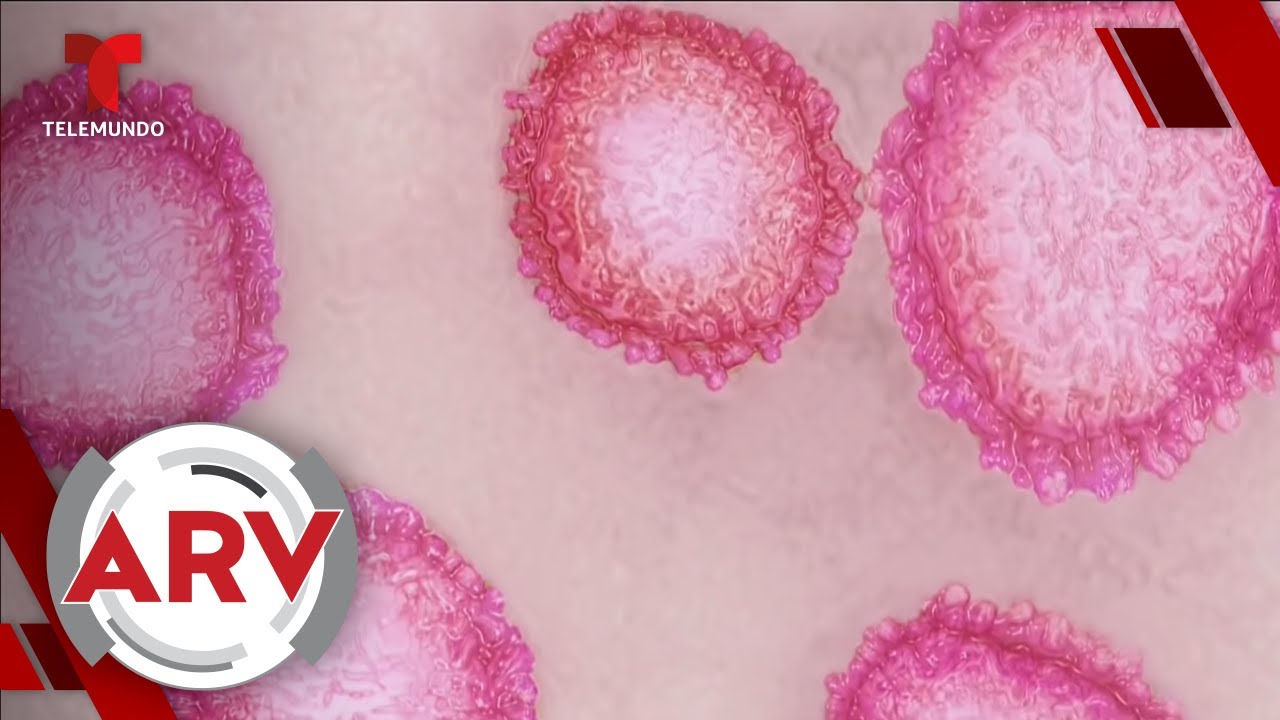 Reportan el primer caso del coronavirus en EE. UU. que ataca los pulmones | Al Rojo Vivo | Telemundo