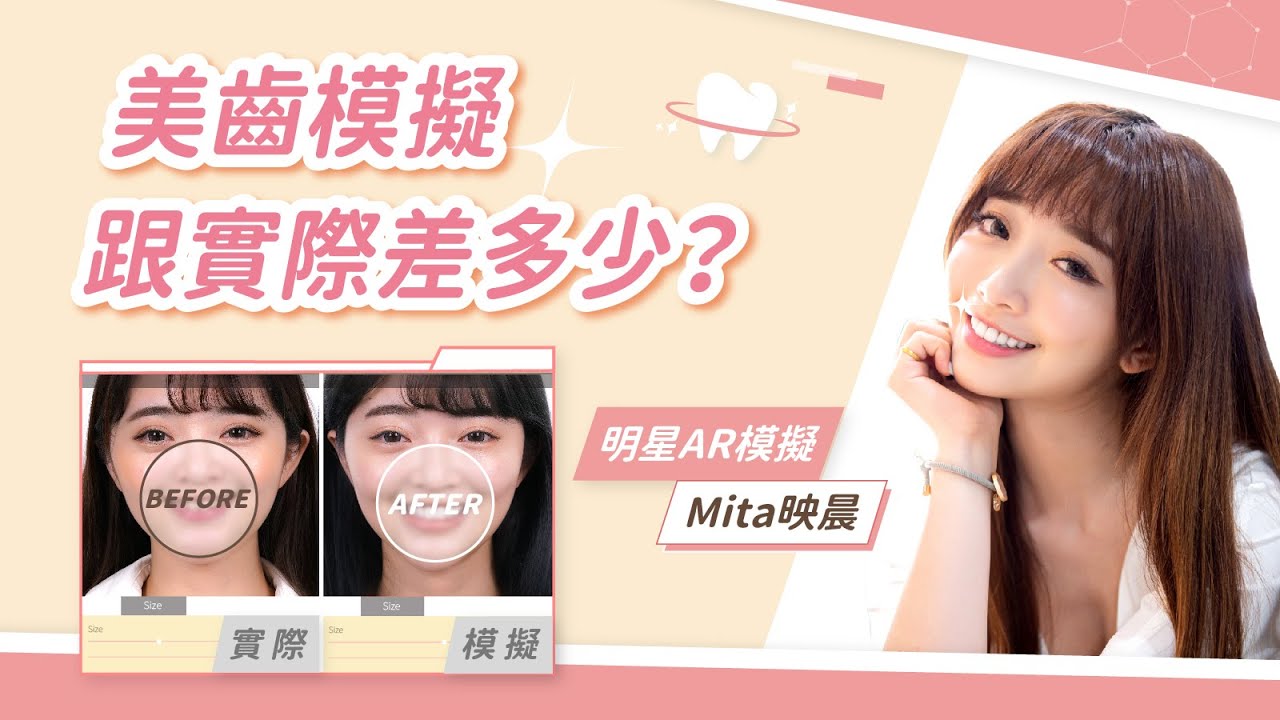 牙齒模擬跟實際成品差別很大嗎？｜明星AR美齒模擬系列EP.4：Mita映晨