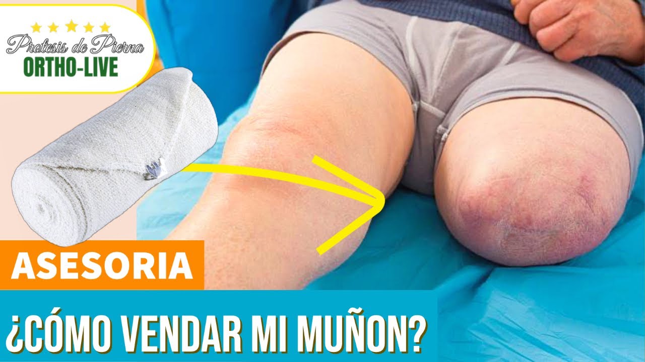¿Cómo vendar mi muñon? AMPUTACION TRANSFEMORAL