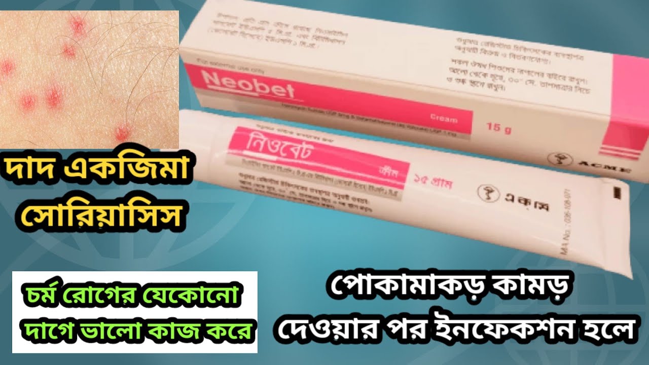neobet cream এর কাজ কি/betametasone 0.1 neomycin sulphate 0.5/ব্যবহার করার নিয়ম বিস্তারিত,,