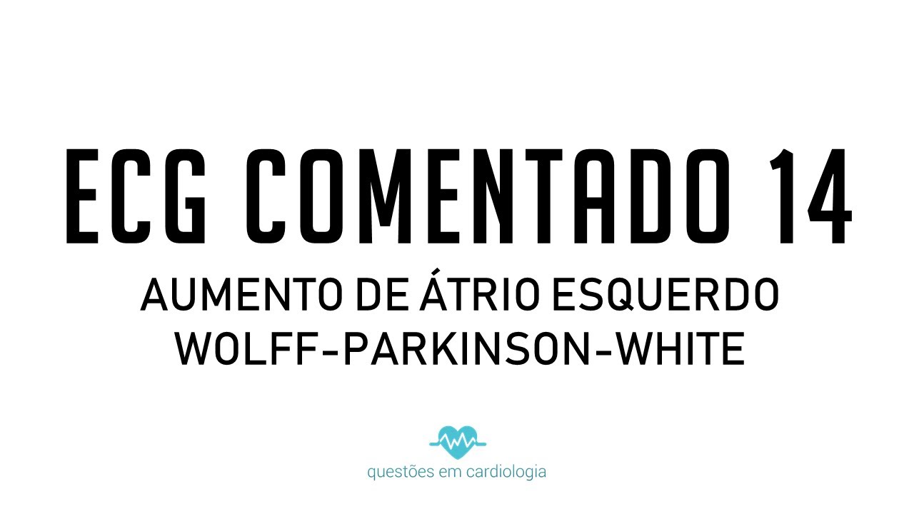 ECG Comentado 14 - Aumento de átrio esquerdo e Wolff-Parkinson-White