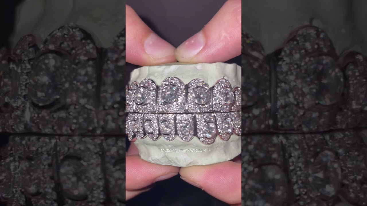 CUSTOM VVS MOISSANITE GRILLZ AT MOISSANITEBAZAAR.COM