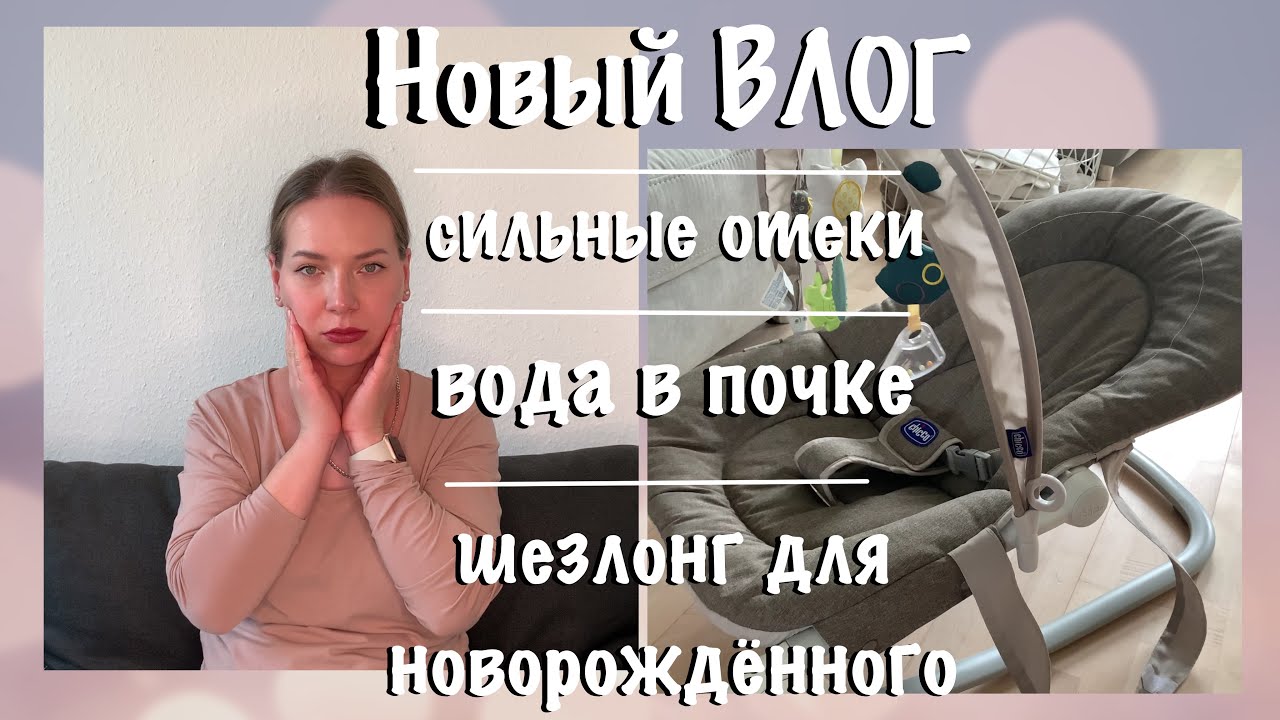 ВЛОГ | 33 неделя беременности | что показало узи | сильные отёки
