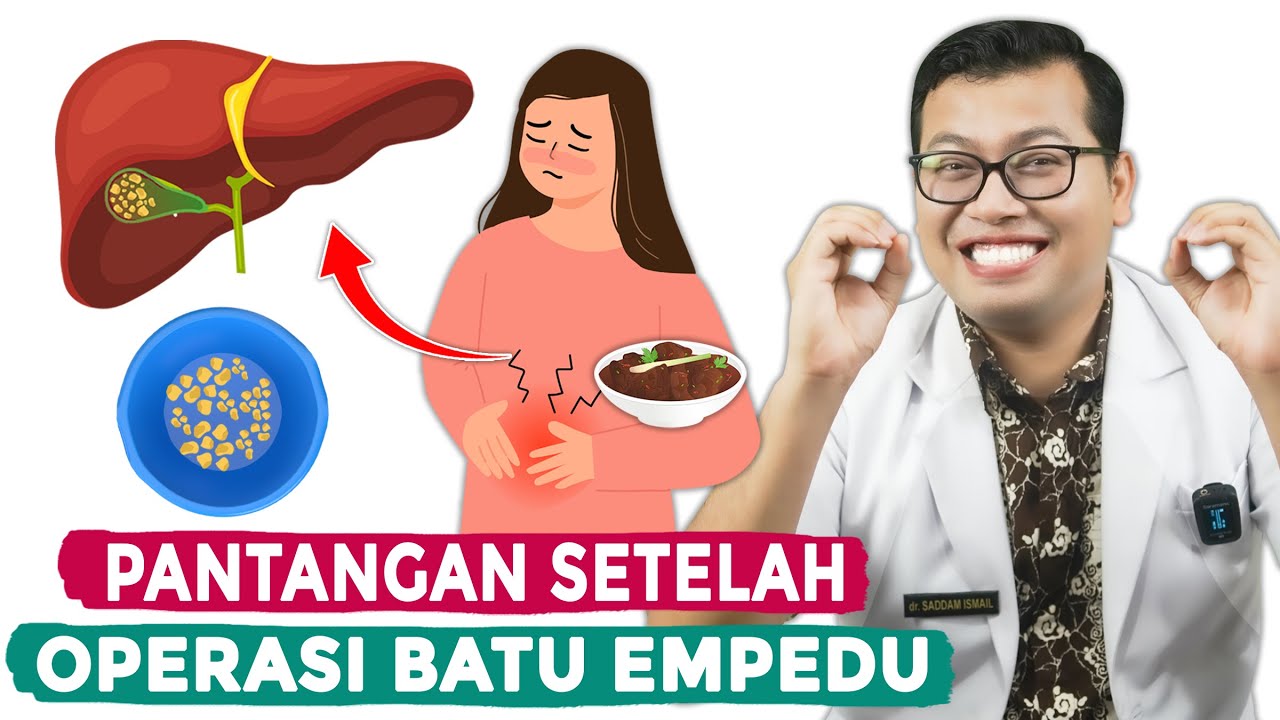 BEGINI PANTANGAN SETELAH OPERASI BATU EMPEDU YANG HARUS DI PATUHI - DOKTER SADDAM ISMAIL
