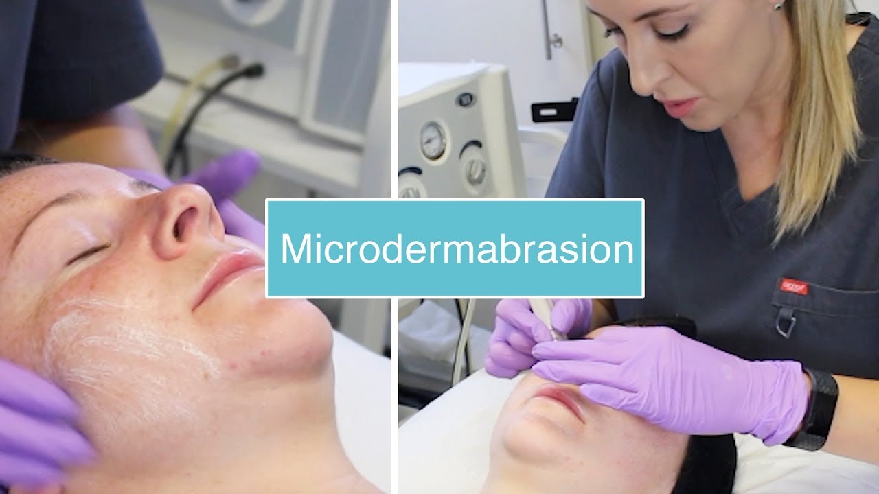 Microdermabrasion | The Laser and Skin Clinic