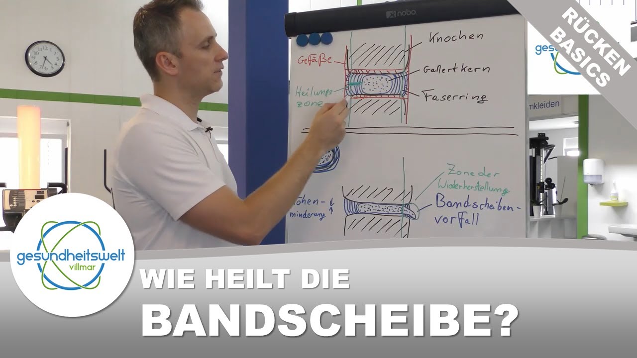 Die Bandscheibe: Wie sollte ich nach einem Bandscheibenvorfall trainieren? (Rücken-Basics)