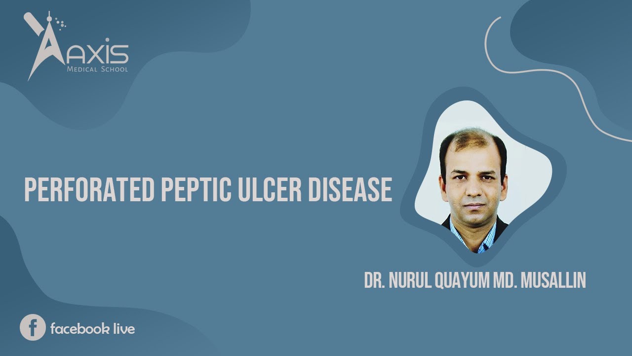 Perforated Peptic Ulcer Disease