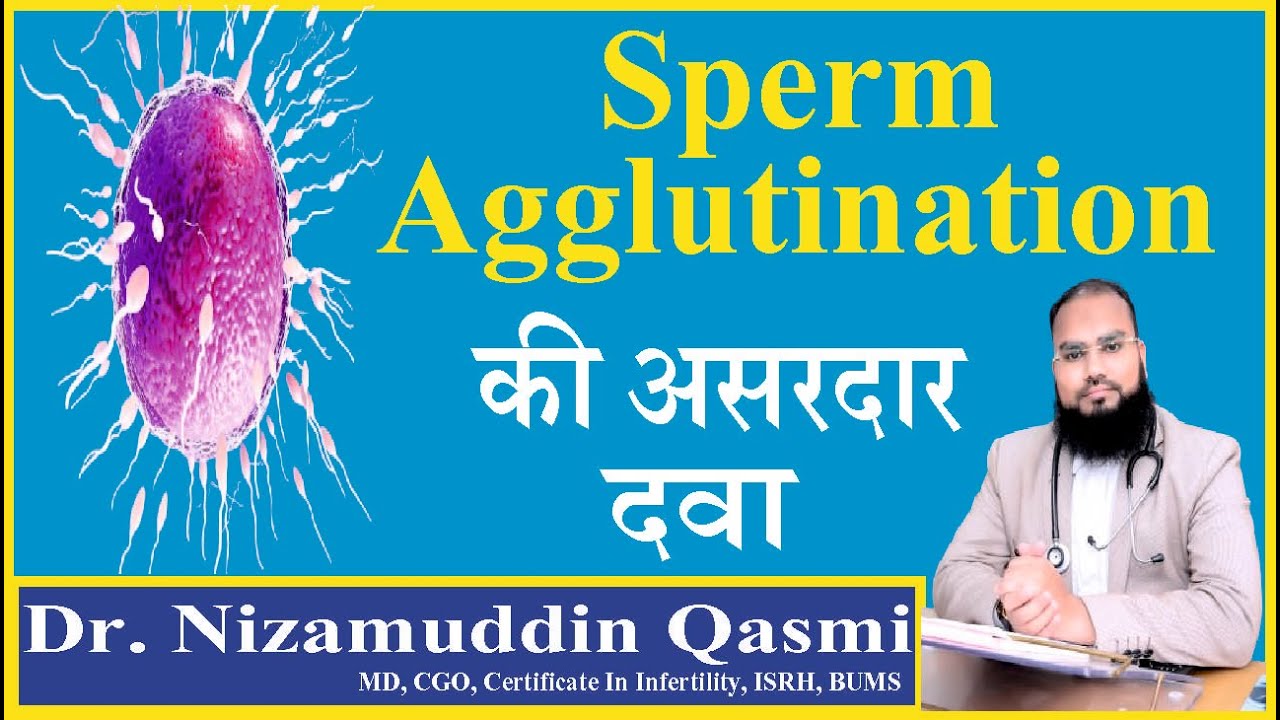Dr Nizamuddin Qasmi Reveals BEST Herbal Treatment for Sperm Agglutination 2024