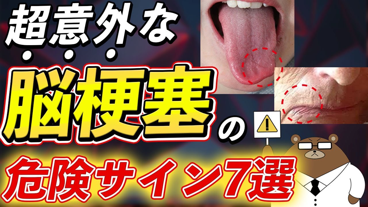 放置厳禁！絶対に見逃さないで！知らないと後悔する脳梗塞の危険な7つの症状とは？