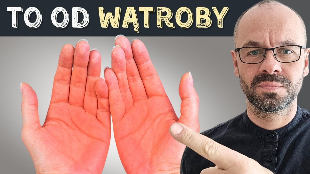 Ten znak na rękach zdradza chorą wątrobę!