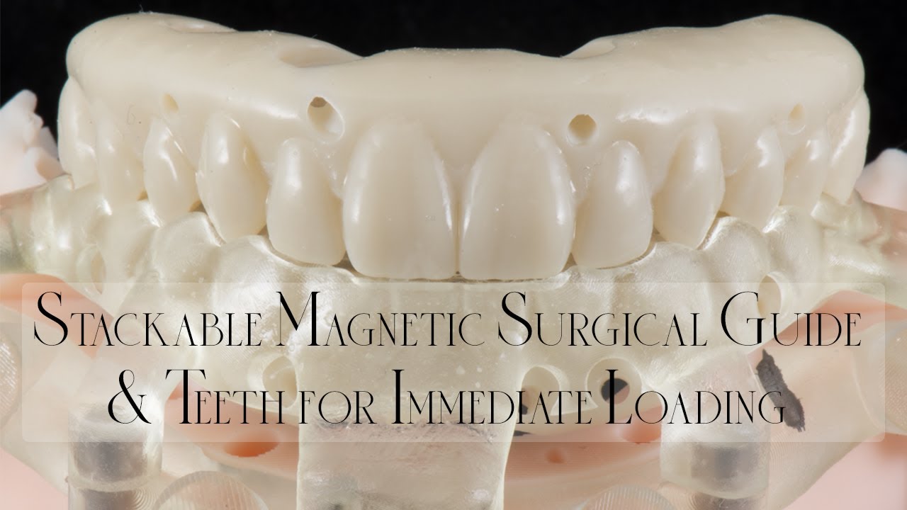 Don't Make Stackable Surgical Guides