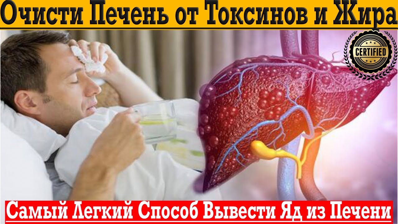 Самый лёгкий способ вывести токсины, жир и яд из печени!