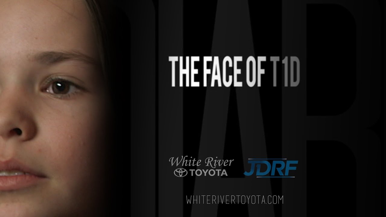 The Face of T1D | White River Toyota