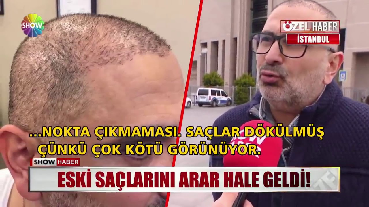 Eski saçlarını arar hale geldi!