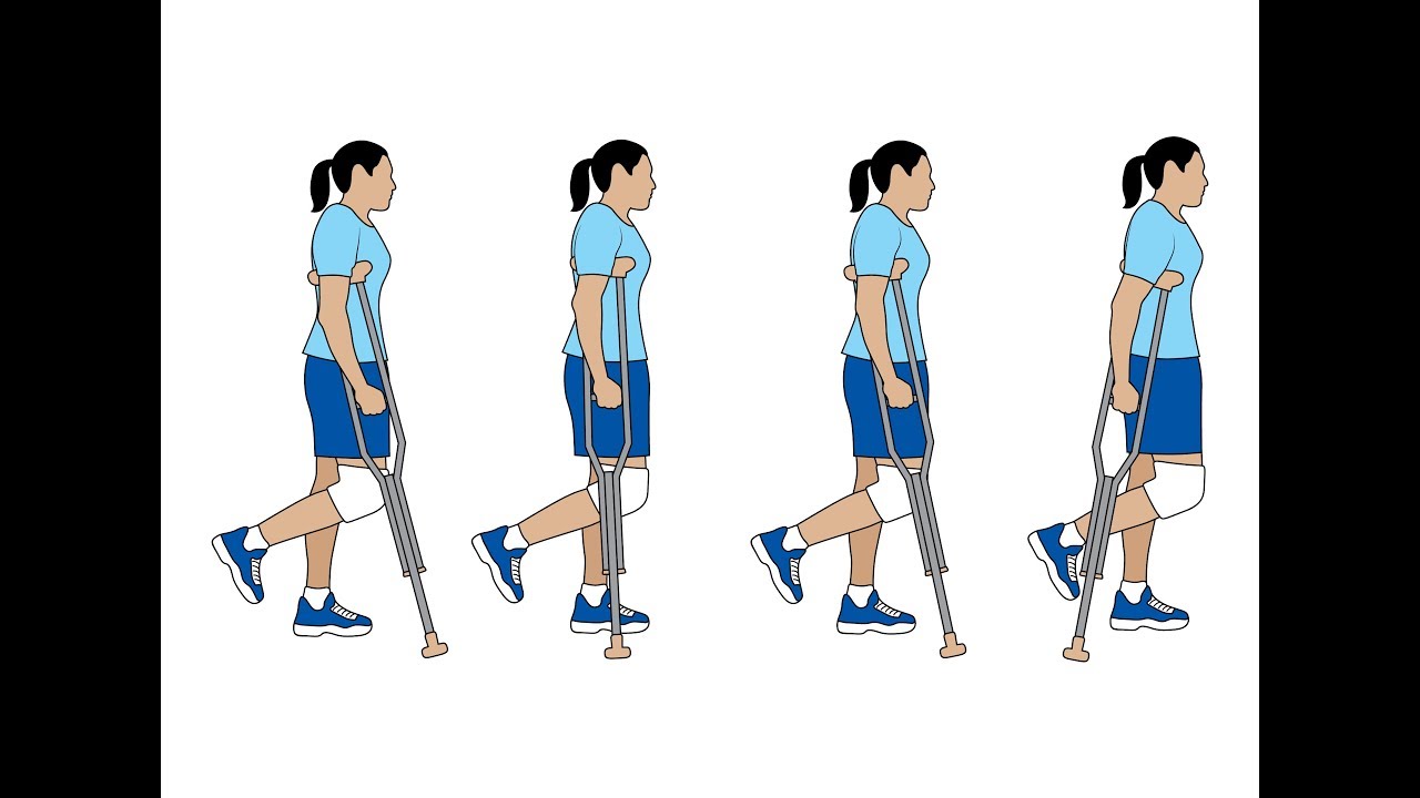 After ACL Surgery When Can I Walk? 10 Key Tips To Walking Normally Faster!