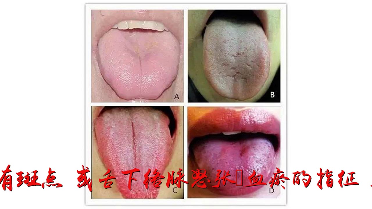 常见4种舌象用药指导，一看就会！