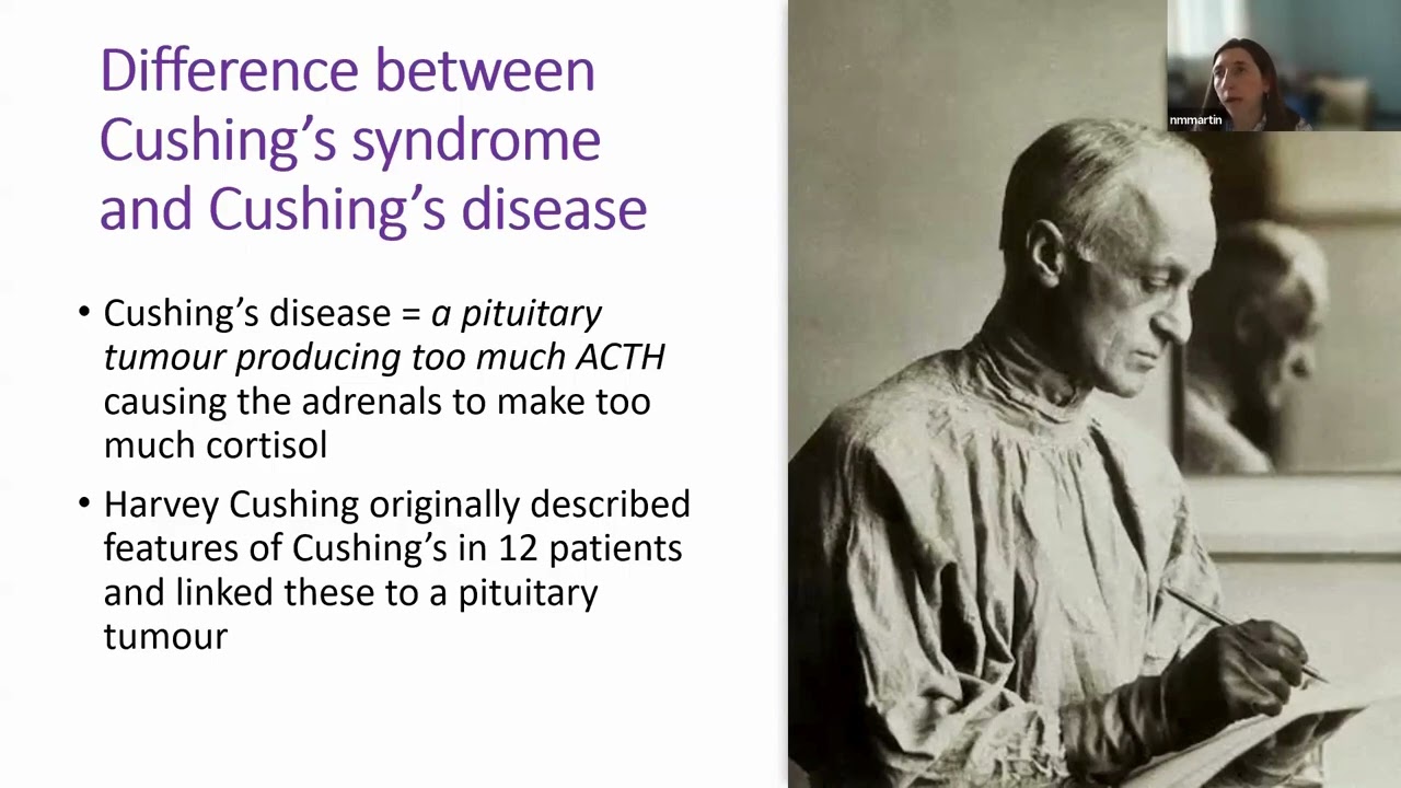 Overview of Cushing's and its treatment with a professor of endocrinology