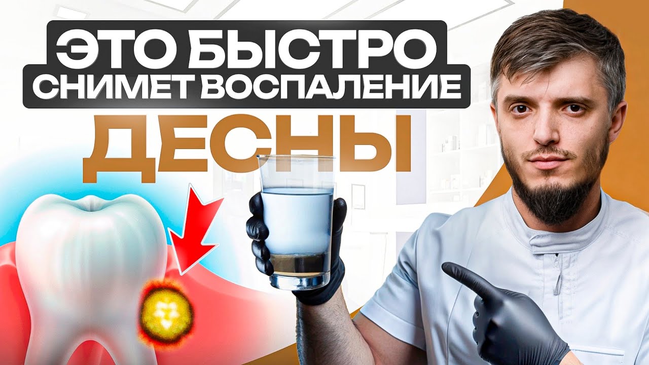 НЕ делайте так при воспалении десен! Как быстро снять воспаление десен в домашних условиях