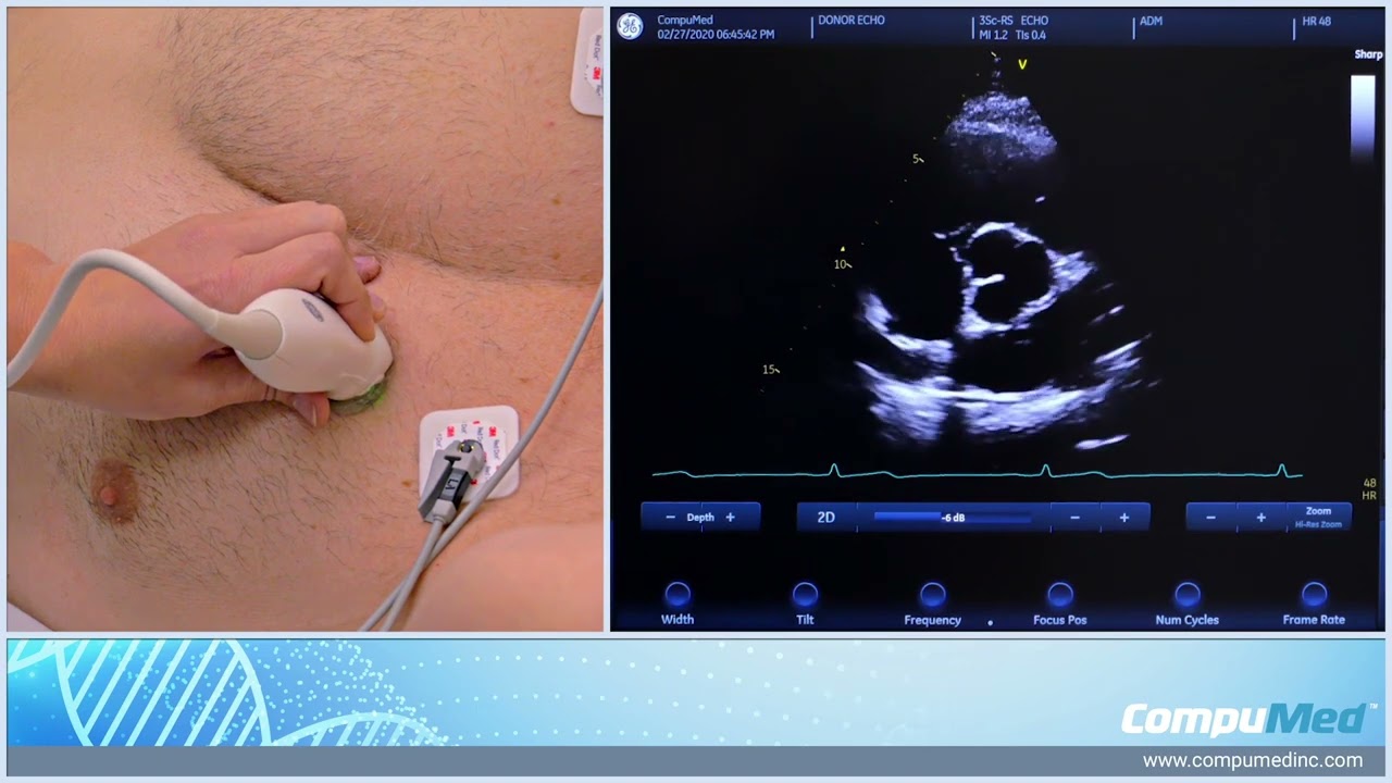 Echocardiographic Imaging Views for a Donor Exam