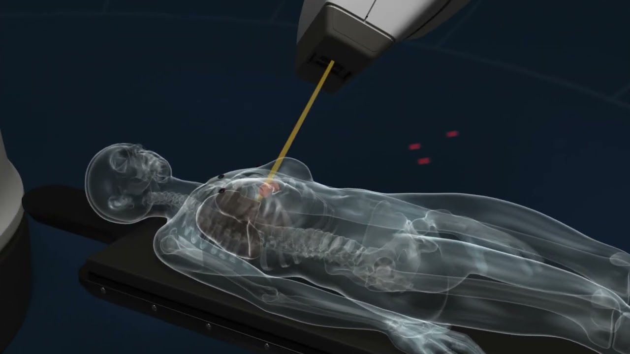 CyberKnife: Game Changer