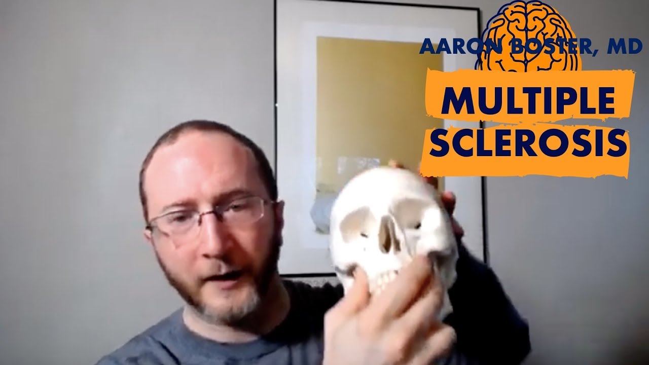 What Causes MS?  How to diagnose MS? Let's talk LIVE!